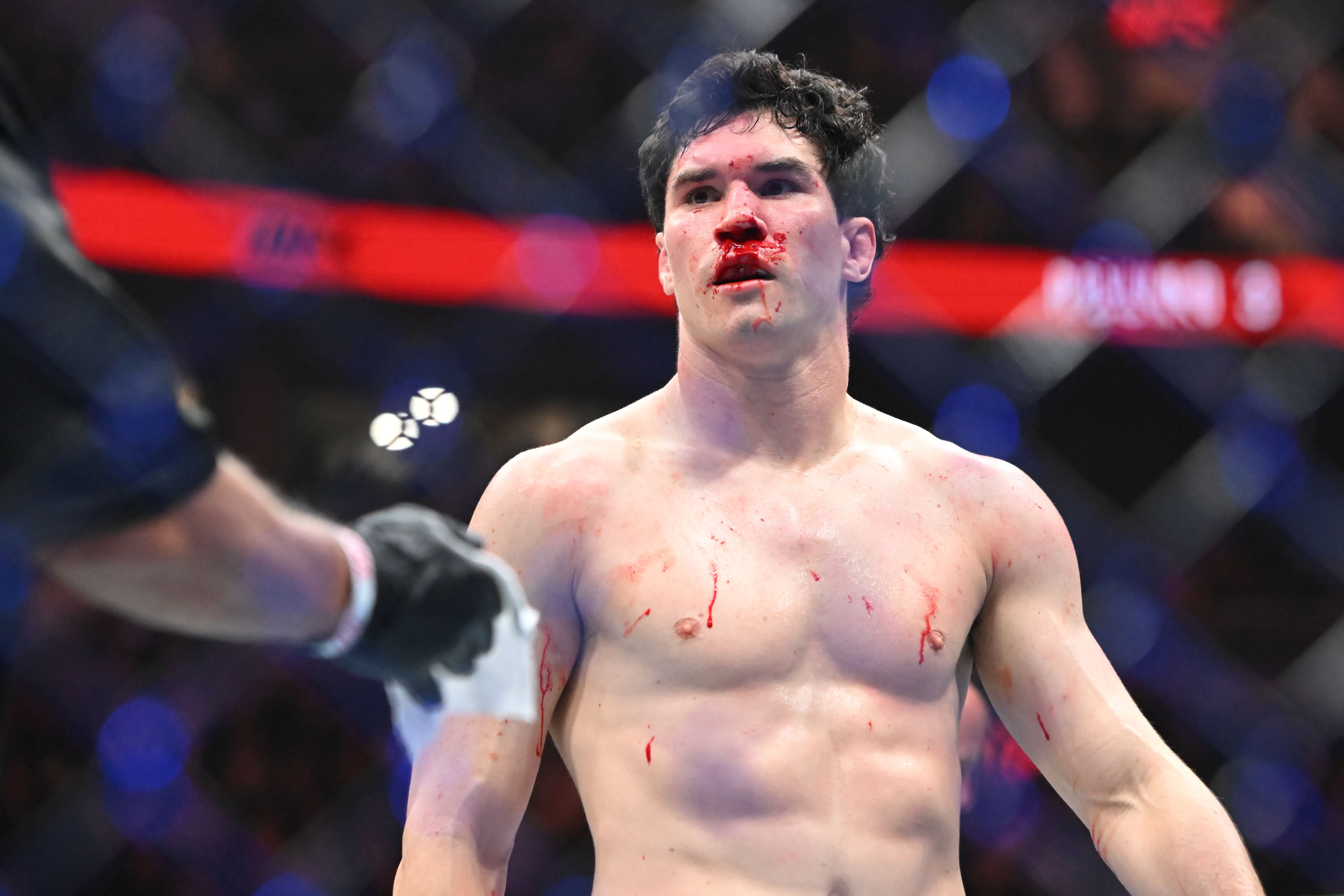 Mike Malott reacts as we make our best Malott vs. Burns prediction